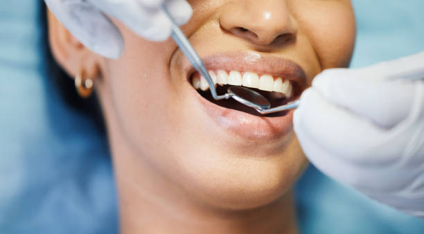 Best Emergency Tooth Extraction in York Harbor, ME
