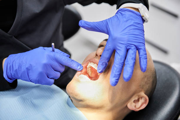 Best Emergency Broken Tooth Repair in York Harbor, ME